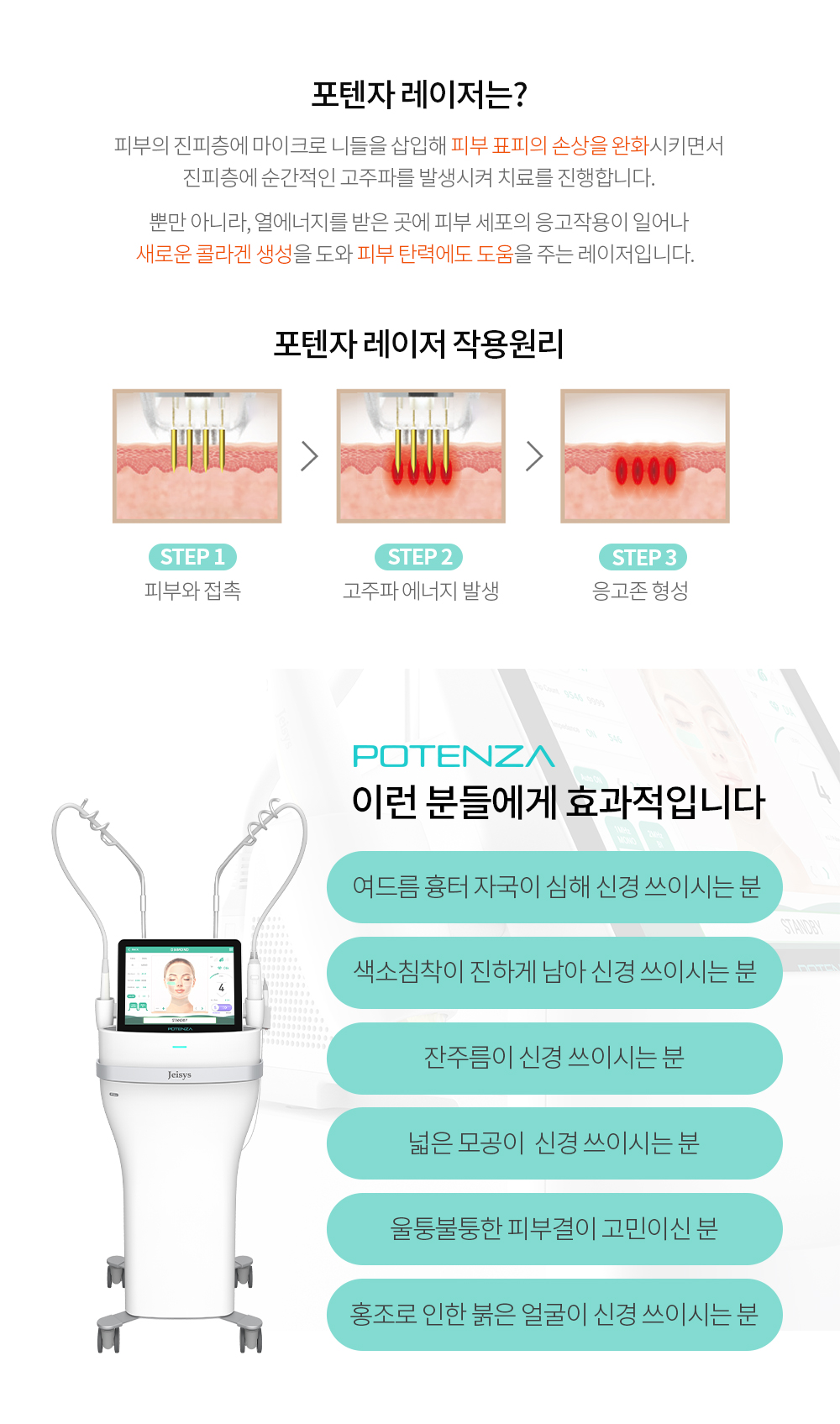 포텐자-레이저_1